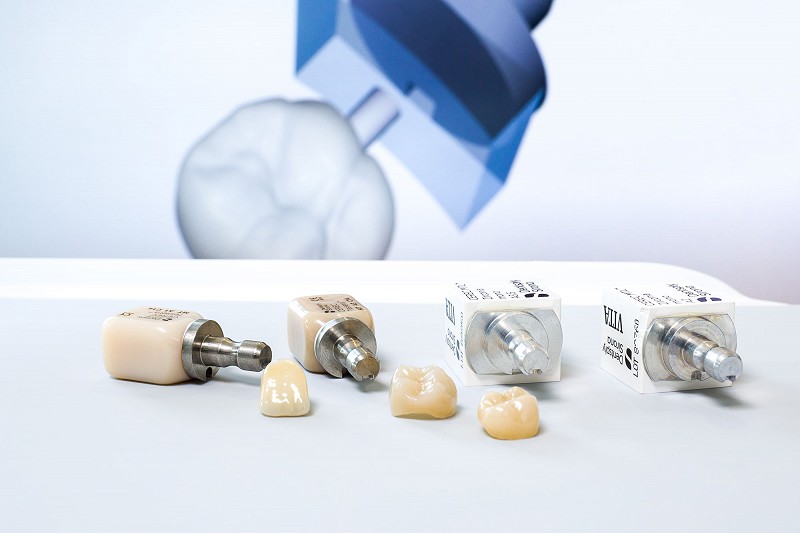 dentalusser – Implantat